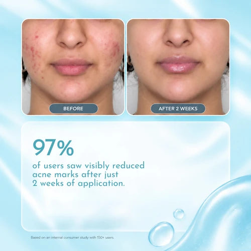 Exfoliating Brightening Serum 30ml