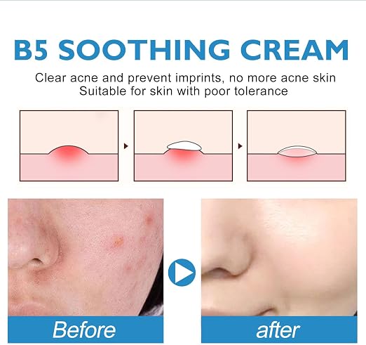 B5 Soothing Repair Cream 40ml